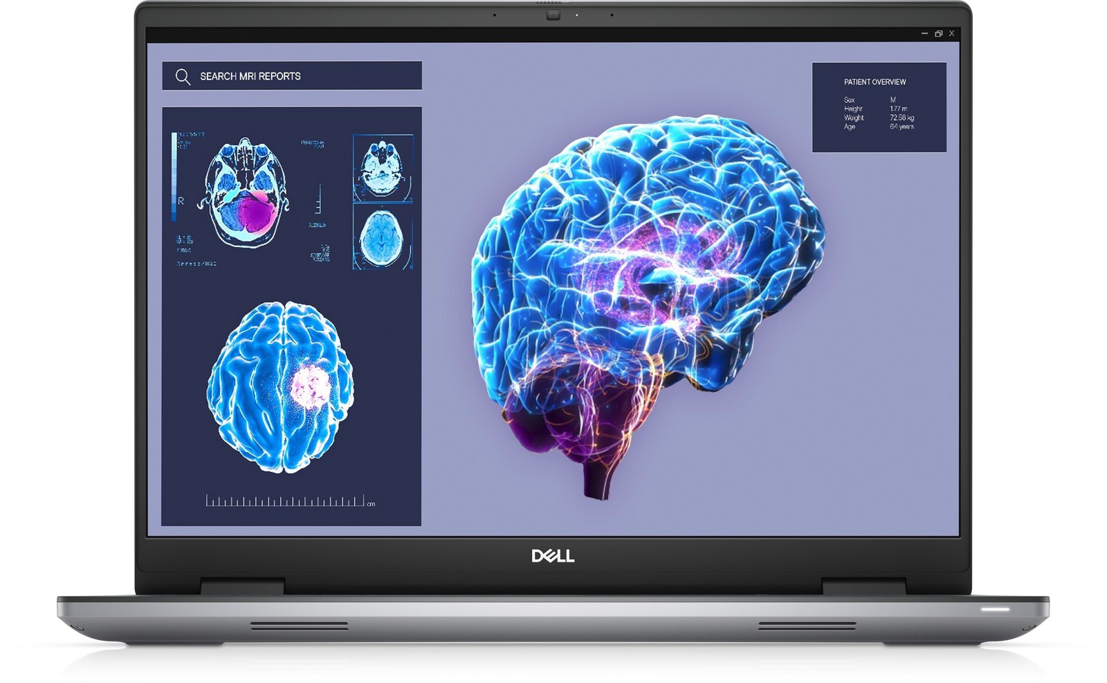 Dell Precision 7680 16" Workstation, Intel i9, 64GB RAM, 1TB SSD,NVIDIA RTX 2000 gallery